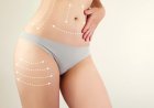 Perfect Your Silhouette with Best Liposuction Doctors in Dubai