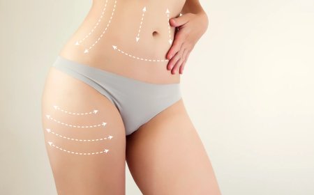 Perfect Your Silhouette with Best Liposuction Doctors in Dubai