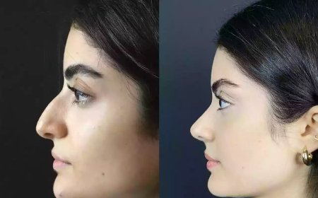 Best Doctors in Dubai Offer 3D Imaging for Personalized Rhinoplasty