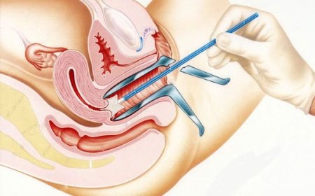 Pap Smear in Dubai: What to Expect and How Often You Need One