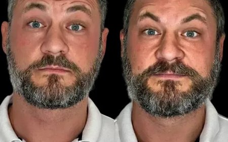 Reveal Brilliance through the Best Doctors in dubai and Profhilo