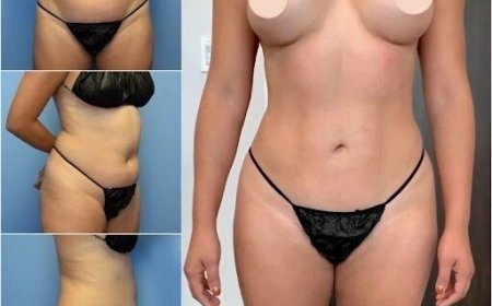 How Body Contouring in Dubai Can Improve Your Body Proportions