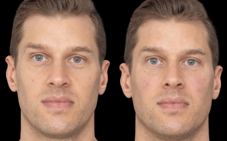 Jawline Fillers with Sculpting: Best Doctors in Dubai for the Treatment
