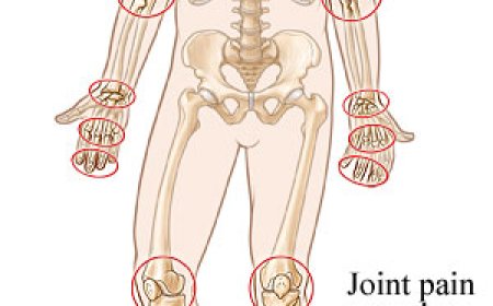 The Science Behind Brufen 400 mg: How Ibuprofen Works to Relieve Pain & Inflammation