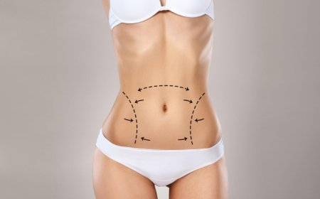 Mini Tummy Tuck in Dubai: Is It a Good Option for Post-Weight Loss Patients?