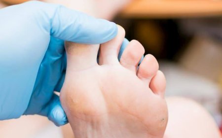 Get Expert Footcare for Corns, Calluses, and Fungal Infections