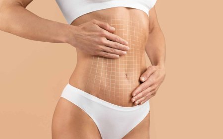 Mini Tummy Tuck in Dubai: How it Differs from a Traditional Tummy Tuck